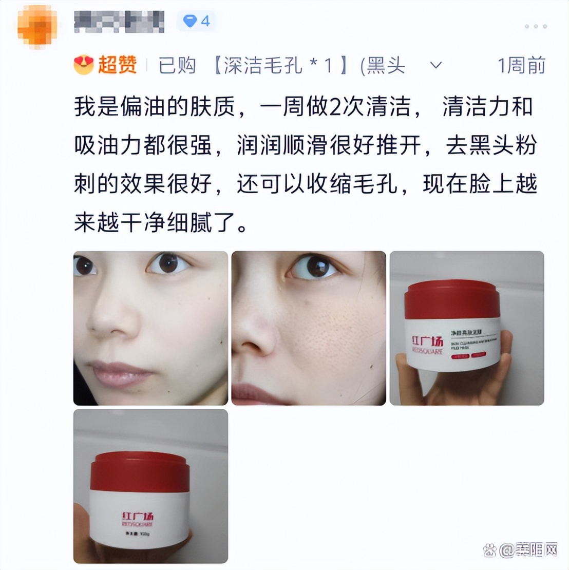 油痘肌泥膜测评_痘痘肌改善方案_红广场净颜泥膜推荐