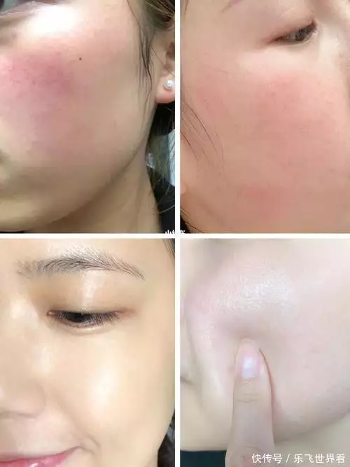 换季必备！6款保湿柔肤水，让敏感肌喝饱水！